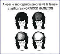 AlopecieFemme.jpg
