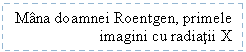 Text Box: Mana doamnei Roentgen, primele  imagini cu radiatii X