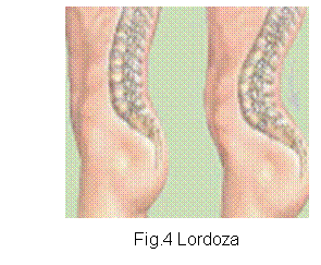 Text Box:  
Fig.4 Lordoza
