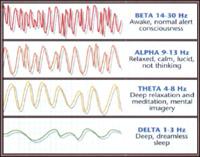 Brainwaves / Agyhullmok